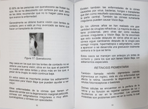Imagen 3 de 3 de Libro Visión Baja ¿qué Es ? ¿qué La Causa? ¿qué Hacer?