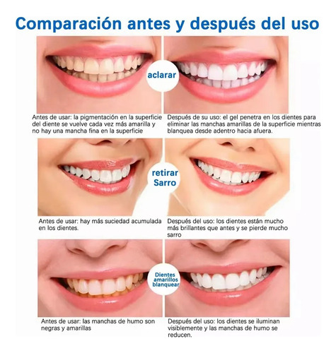 Kit De 14 Pares De Pegatinas Blanqueadoras De La Versión 5d