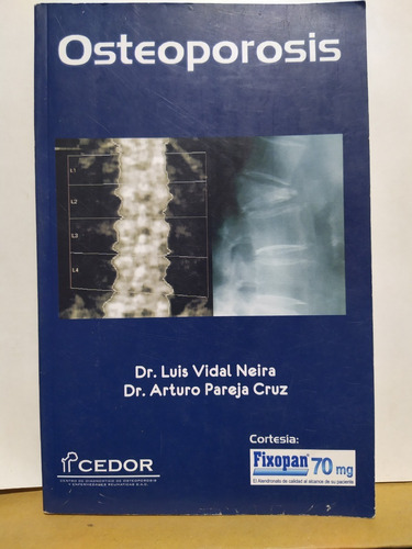 Osteoporosis ( Libro Medicina )