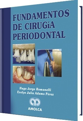  Fundamentos De Cirugía Periodontal