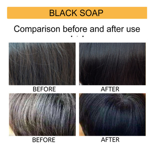 Saas 2 Peças De Nova Barra De Shampoo Para