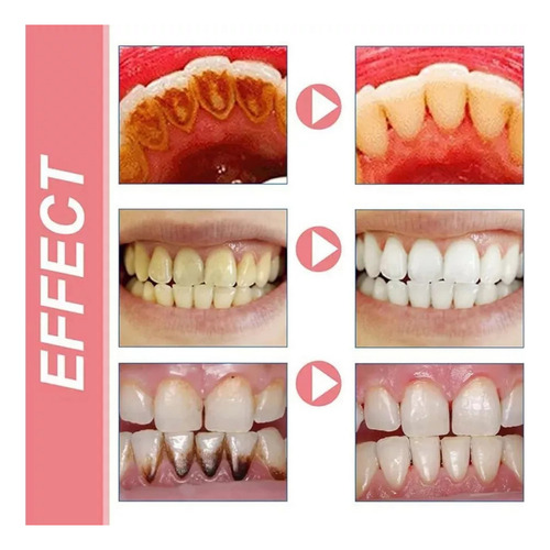 B Pasta De Dientes Sp8 Probiotics Bright White, Fresh Breath