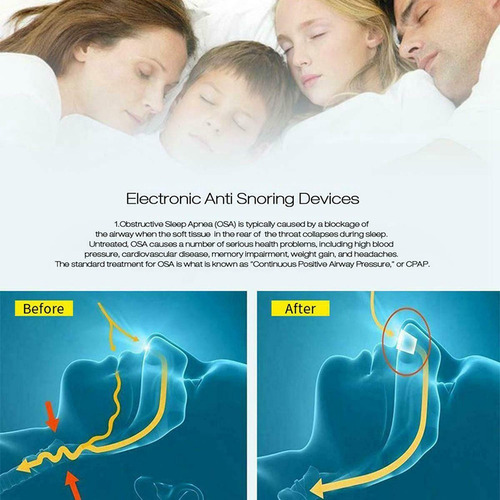Imagen 5 de 6 de Micro Cpap Dispositivo Antirronquidos Para Apnea Del Sueño