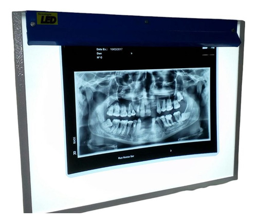 Negatoscopio Led Para Mamografia Digital , Rx E Odonto.