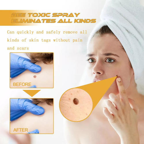 A 3pcs Tag Recede Bee,tag Recede Bee Spray Para Mujeres Y