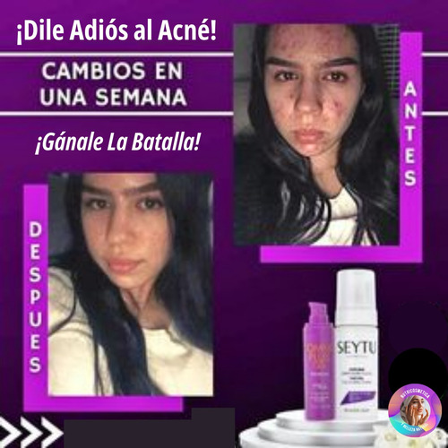 Dúo Anti Acne Cicatrices Manchas Piel Sensible Unisex