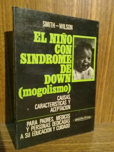 El Niño Con Sindrome De Down - Smith