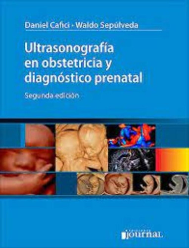 Ultrasonografía En Obstetricia Y Diagnóstico Prenatal Ed.2º