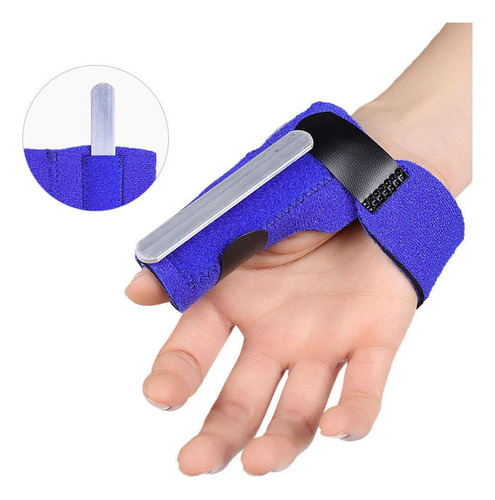 Fractura Mano Mano Derecha Izquierda Metal Azul Izquierda