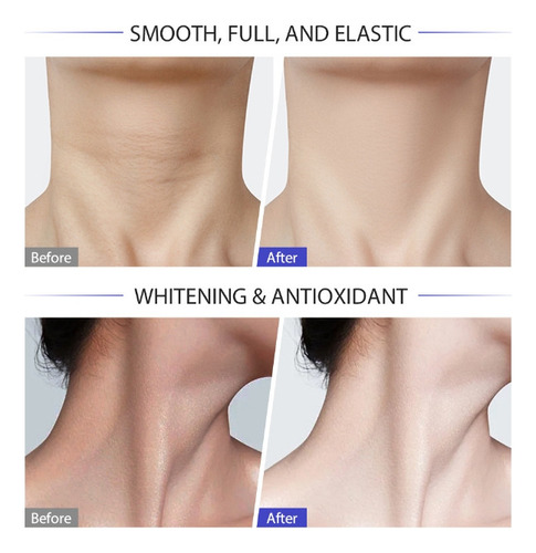 2025 Última Weud Crema Para El Cuello - ¡reafirma 2pcs