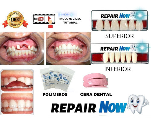 Imagen 8 de 8 de Kit Protesis Dental Diente Provisorio Agnovedades