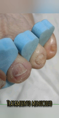 Pedicura A Domicilio