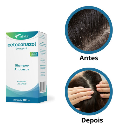 Kit Com 10 Shampoo Cetoconazol Anticaspa 100ml Nativita