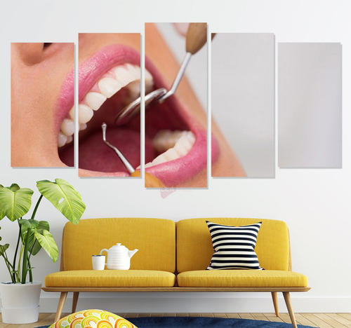 Políptico Dentista Ccd44 Canvas Grueso 150x80