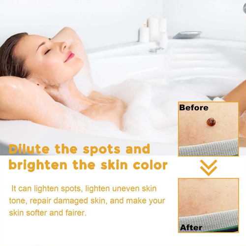 Crema Antipigmentaria Para Eliminar Las Verrugas Del Herpes,