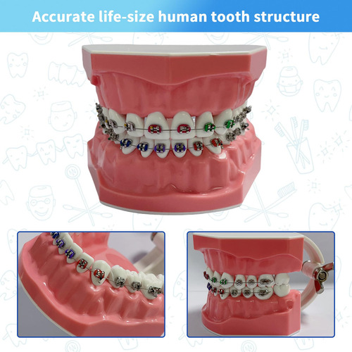 Modelo Dental Typodont Para Ortodoncia Educativa Con Frenill