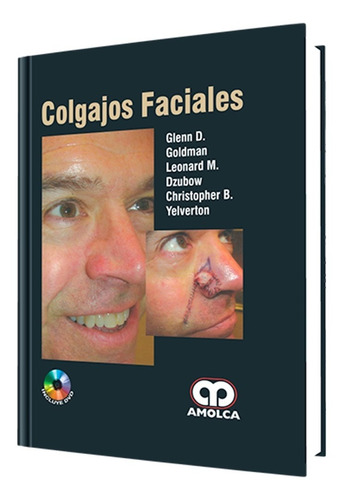 Colgajos Faciales. El Libro Necesario Para Cirugía Plástica.