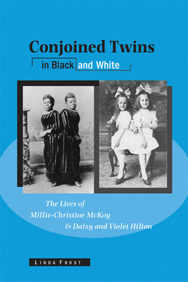 Libro Conjoined Twins In Black And White: The Lives Of Mi...