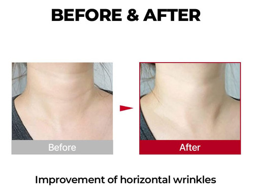 Medipeel Crema Para Cuello De Colageno Premium Reafirmante