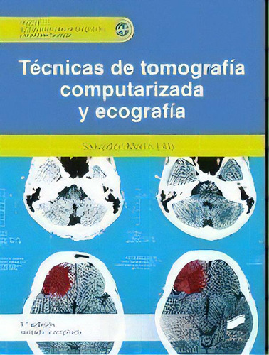 Tecnicas De Tomografia Computerizada Y Ecografia 2ãâª Ed, De Marin Lillo,salvador. Editorial Sintesis, Tapa Blanda En Español