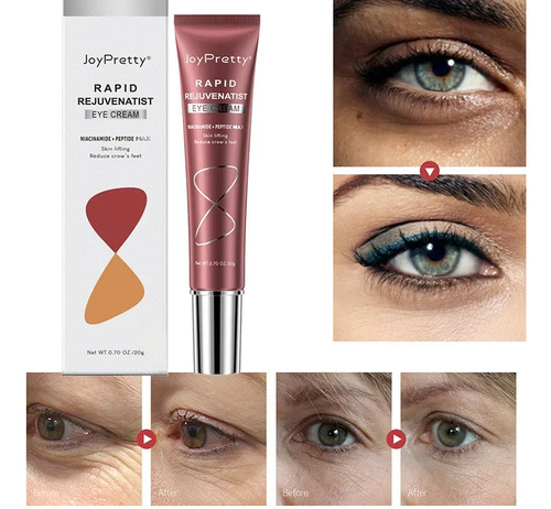 Crema Instantánea Para Eliminar Ojeras Y Ojeras