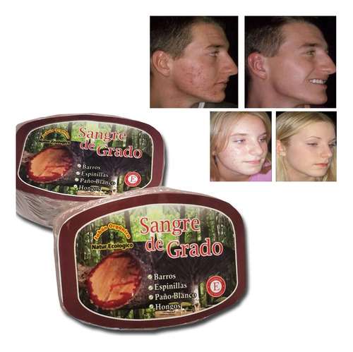 Jabón Natural De Sangre De Grado 2 Und