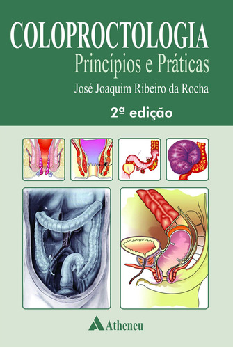 Coloproctologia - princípios e práticas, de Rocha, José Joaquim Ribeiro da. Editora Atheneu Ltda, capa mole em português, 2011