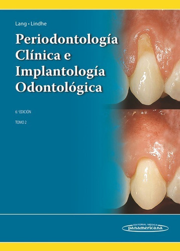 Periodontologa Clnica E Implantologa Odontolgica  - Aauytzz