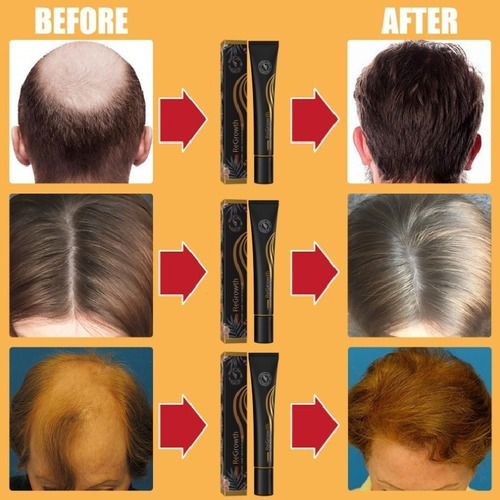 Suero Orgánico Para El Crecimiento Del Cabello Regrewth