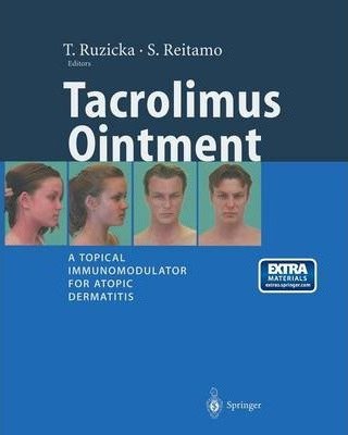 Libro Tacrolimus Ointment - T. Ruzicka