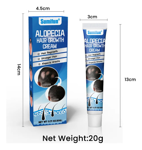 Crema Para El Cuidado De La Alopecia Areata , 20g