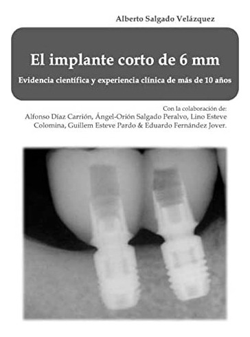 Libro: El Implante Corto 6 Mm: Evidencia Científica Y Exp