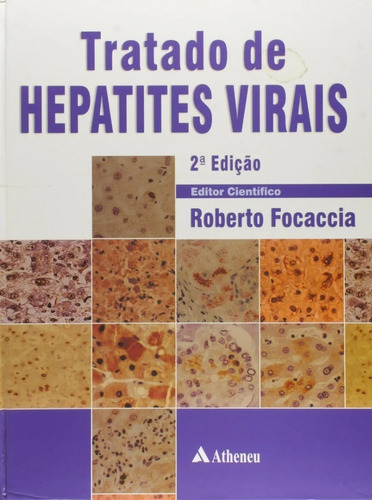 Tratado De Hepatites Virais 2 Ed, De Roberto Focaccia. Editora Atheneu Em Português