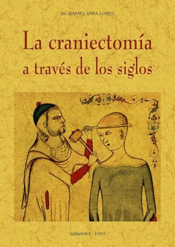 Libro La Craniectomia A Través De Los Siglos De Vara Lopez R