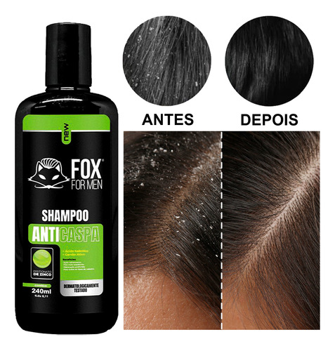 Shampoo Anticaspa Refrescante Limpeza Profunda Xampu Shampu