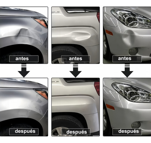 Kit Ventosas Saca Golpes Repara Abolladuras Auto 77pcs