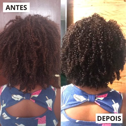 Kit Explosão Oleo Africanos 7 Óleos Precisos Beleza Natural
