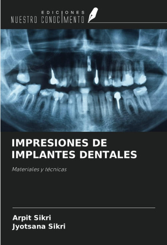 Libro: Impresiones De Implantes Dentales: Materiales Y Técni