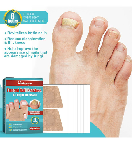 - Tratamiento De Hongos En Las Uñas De Los Pies, 1