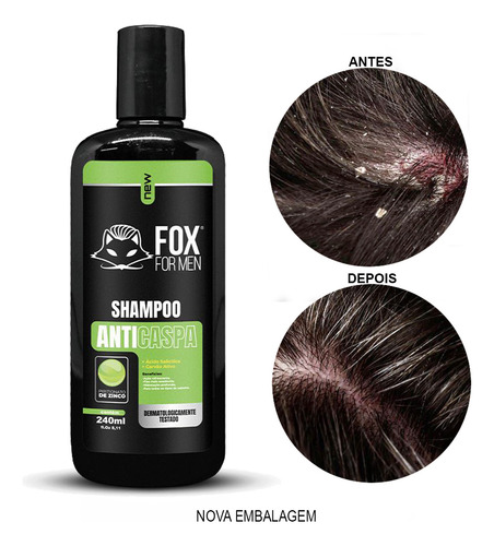 Shampoo Anticaspa Fox For Men Antiqueda Limpa E Hidrata 4 Un