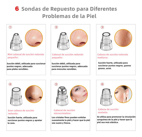 Removedor De Espinillas, Limpiador De Poros Usb Recargable