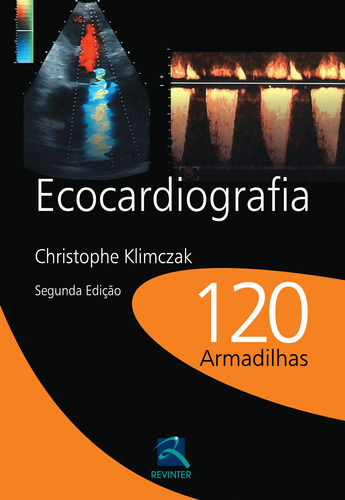 Ecocardiografia: 120 Armadilhas, de Klimczak, Christophe. Editora Thieme Revinter Publicações Ltda, capa mole em português, 2012
