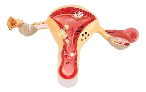 Modelo Anatómico De Útero, Ovarios, Modelo De Vagina Humana