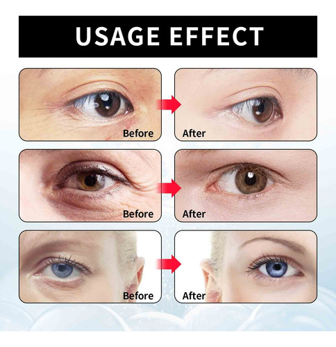 N Crema Reductora De Arrugas Para Ojos, Crema Reparadora Y R