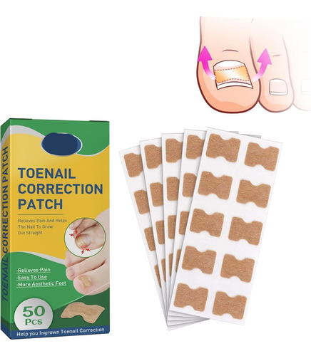 Parche Para Uñas Encarnadas,parche Corrector De Uñas De Los