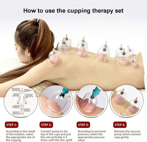 Terapia de succion en la espalda new arrivals