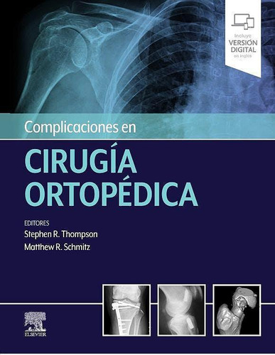 Complicaciones En Cirugía Ortopédica - Thompson - Elsevier