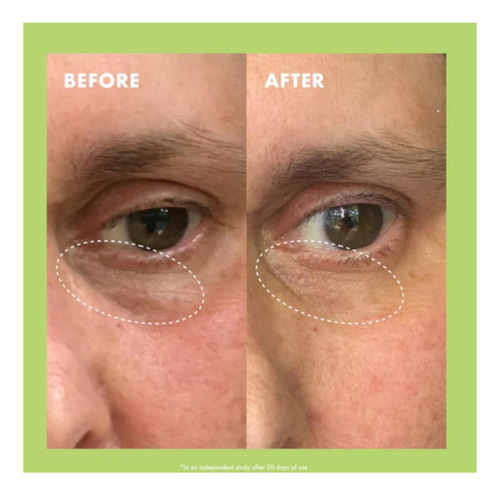 Kopari Niacinamide & Caffeine Eye Bright Cream