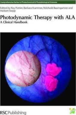 Photodynamic Therapy With Ala : A Clinical Handbook - Don...