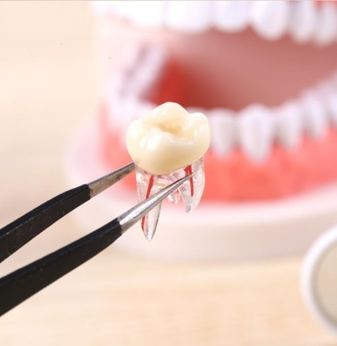 Imagen 5 de 10 de Molar Para Práctica Endodoncia Enseñanza Santiago